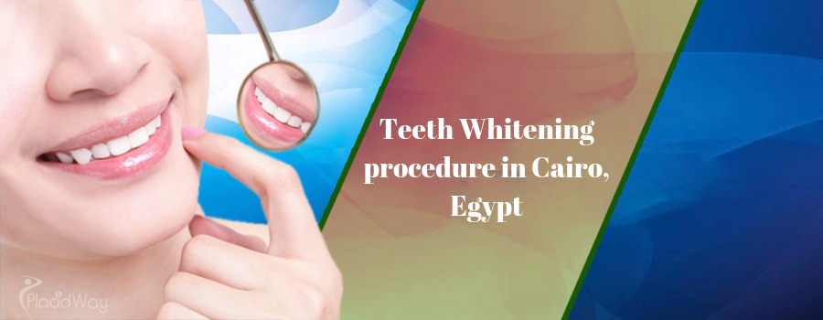 Teeth Whitening in Cairo, Egypt